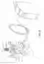Fig. 09 - IMPLANT POSITIONING DEVICE FOR AN ORTHODONTIC BRACE