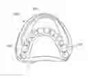 Fig. 01 - Method of fabricating a denture