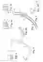 Fig. 02 - Pelvic implant needle system and method