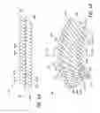 Fig. 09 - ANEURYSM TREATMENT COILS