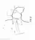 Fig. 07 - METHOD AND APPARATUS FOR RECAPTURING AN IMPLANT FROM THE LEFT ATRIAL APPENDAGE