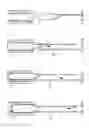 Fig. 33 - Method and apparatus for treating urethral stricture