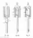 Fig. 05 - Method and apparatus for treating urethral stricture