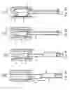 Fig. 06 - Method and apparatus for treating urethral stricture