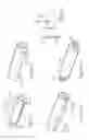 Fig. 22 - Method and apparatus for treating urethral stricture