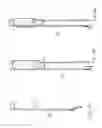 Fig. 34 - Method and apparatus for treating urethral stricture