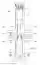 Fig. 22 - Preloaded wire for endoluminal device