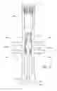 Fig. 28 - Preloaded wire for endoluminal device