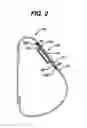 Fig. 03 - Injection zone markers for biomedical implants