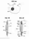 Fig. 05 - Injection zone markers for biomedical implants