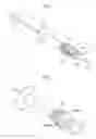 Fig. 02 - Intraocular lens injector
