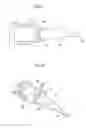 Fig. 06 - Intraocular lens injector