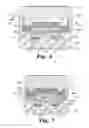 Fig. 05 - Expandable interbody fusion device