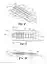 Fig. 06 - Expandable interbody fusion device