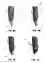Fig. 06 - Guides for fracture system
