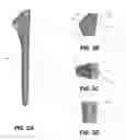 Fig. 07 - Guides for fracture system