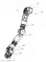 Fig. 01 - Arm prosthetic device