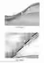 Fig. 07 - Compliant implantable medical devices and methods of making same