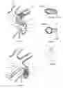 Fig. 02 - Device and method for increasing flow through the left atrial appendage