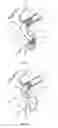 Fig. 06 - Device and method for increasing flow through the left atrial appendage