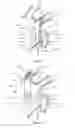 Fig. 07 - Device and method for increasing flow through the left atrial appendage