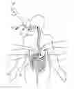Fig. 01 - Gastric tubes having tethered plugs and methods of use
