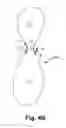 Fig. 07 - Gastric devices, systems, and methods