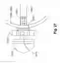 Fig. 33 - Gastric devices, systems, and methods