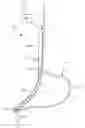 Fig. 01 - Illuminated gastric tubes and methods of use