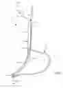 Fig. 07 - Illuminated gastric tubes and methods of use