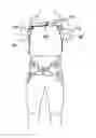 Fig. 01 - Orthopedic device for treating complications of the hip
