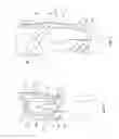 Fig. 02 - Orthopedic device for treating complications of the hip