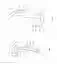 Fig. 03 - Orthopedic device for treating complications of the hip