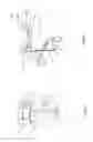Fig. 07 - Orthopedic device for treating complications of the hip
