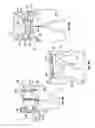Fig. 16 - Orthopedic device for treating complications of the hip