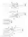 Fig. 19 - Orthopedic device for treating complications of the hip
