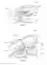 Fig. 26 - Orthopedic device for treating complications of the hip