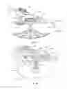 Fig. 27 - Orthopedic device for treating complications of the hip
