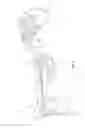 Fig. 30 - Orthopedic device for treating complications of the hip