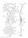 Fig. 31 - Orthopedic device for treating complications of the hip