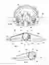 Fig. 32 - Orthopedic device for treating complications of the hip