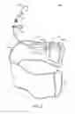 Fig. 08 - Variable pressure upper torso braces and methods related thereto