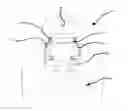 Fig. 01 - Head and neck support apparatus