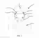Fig. 02 - Head and neck support apparatus