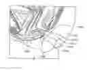Fig. 01 - Devices and methods for treating accidental bowel leakage