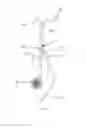 Fig. 08 - Sit-to-stand and walking assistive mobility aid