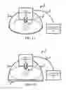 Fig. 02 - LIGHTWEIGHT ELECTRO-MECHANICAL CHEST COMPRESSION DEVICE