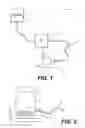 Fig. 02 - Intraoral fluid delivery system and method