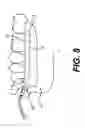 Fig. 06 - Intraoral fluid delivery system and method