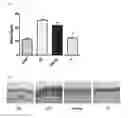 Fig. 03 - Skin-moisturising or wrinkle-improving external composition and cosmetic composition